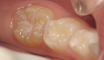 étude de cas d'hygiene dentaire